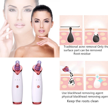 Hair Remover 