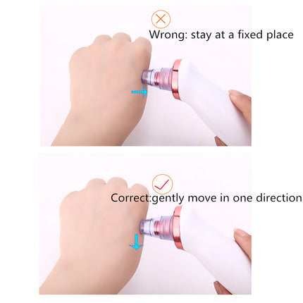  Remover Instrument